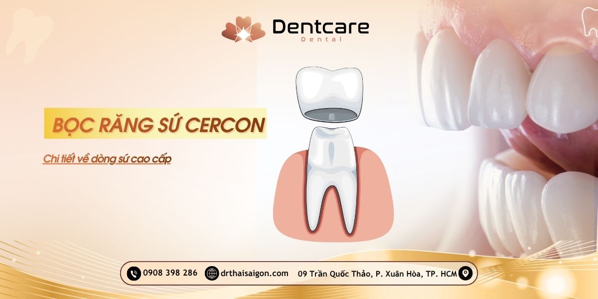 bọc răng sứ cercon
