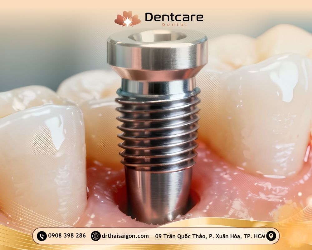 trồng răng implant có đau không