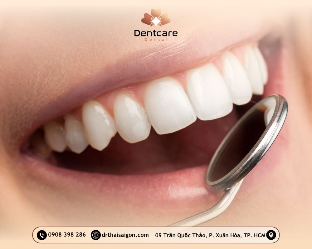 Top 5 dịch vụ thẩm mỹ răng
