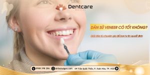 dán sứ veneer có tốt không