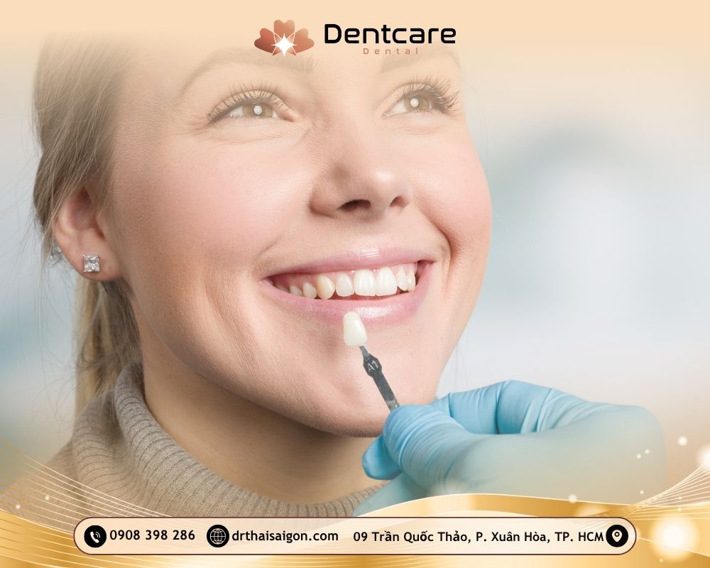 dán sứ veneer có tốt không