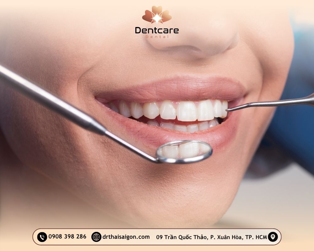 Top 5 dịch vụ thẩm mỹ răng