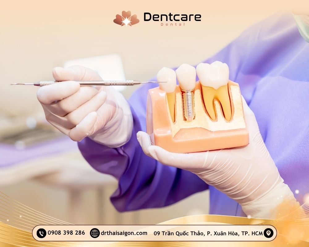 trồng răng implant quận 3
