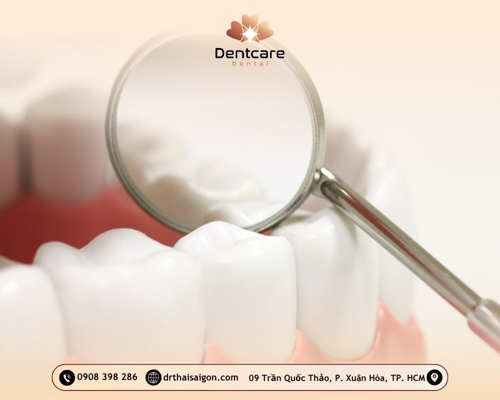 Top 6 sai lầm thẩm mỹ răng