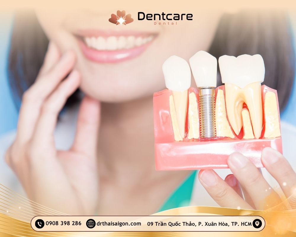 trồng răng implant trả góp