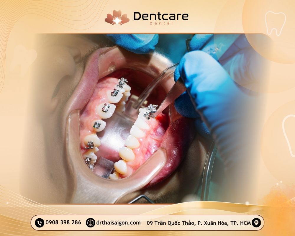 bác sĩ nha làm không đau