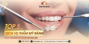 Top 5 dịch vụ thẩm mỹ răng