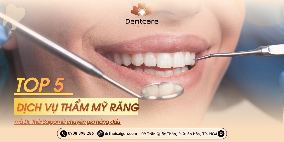 Top 5 dịch vụ thẩm mỹ răng