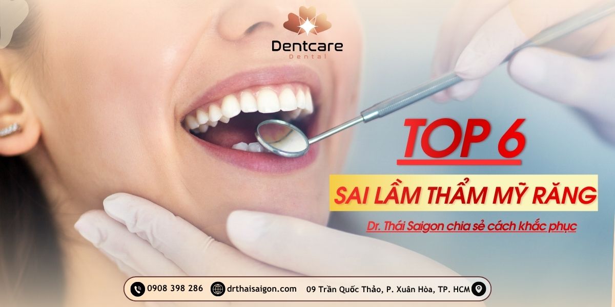 Top 6 sai lầm thẩm mỹ răng