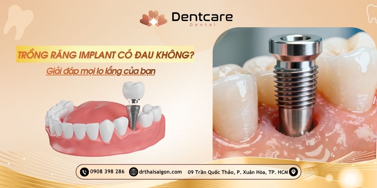 trồng răng implant có đau không