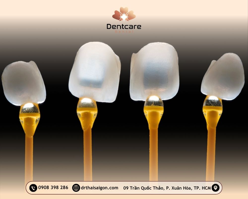 dán sứ veneer giá bao nhiêu