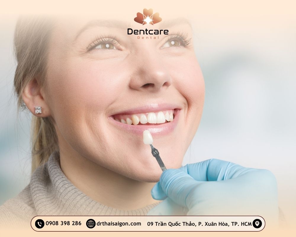 dán sứ veneer giá bao nhiêu